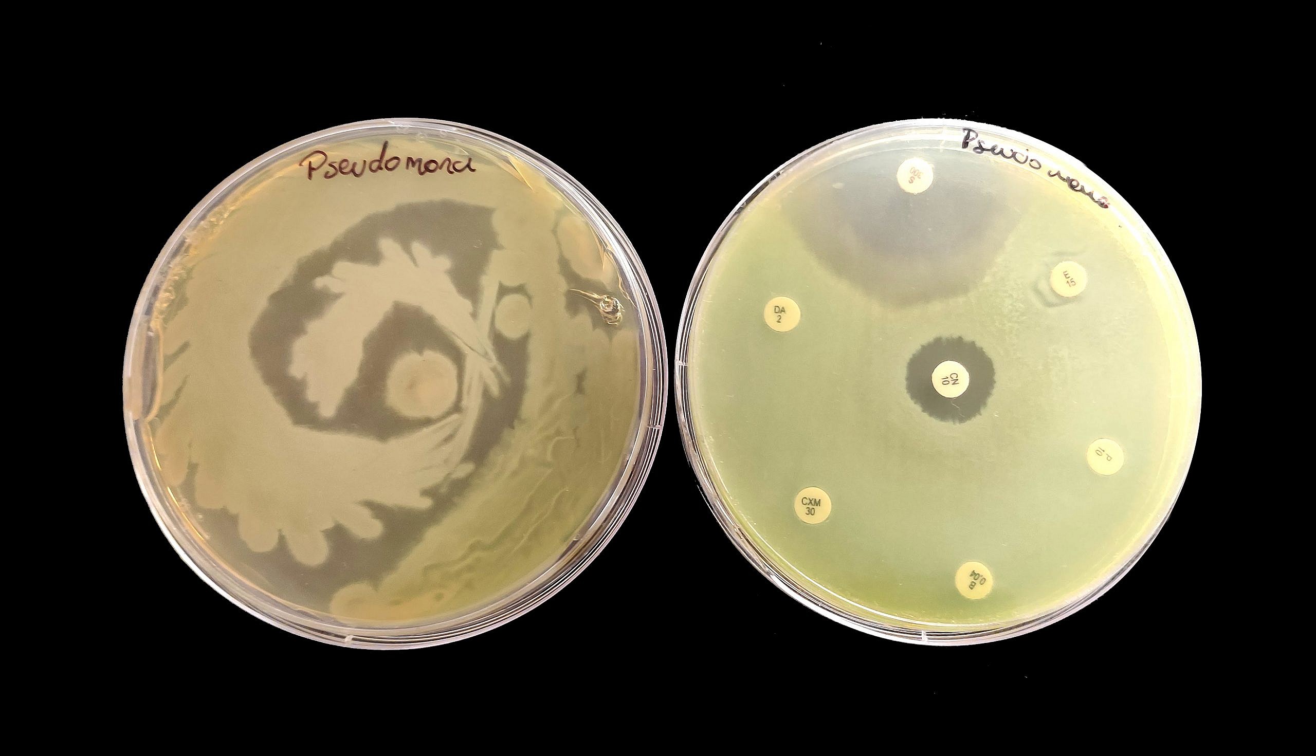 pseudomona aeruginosa