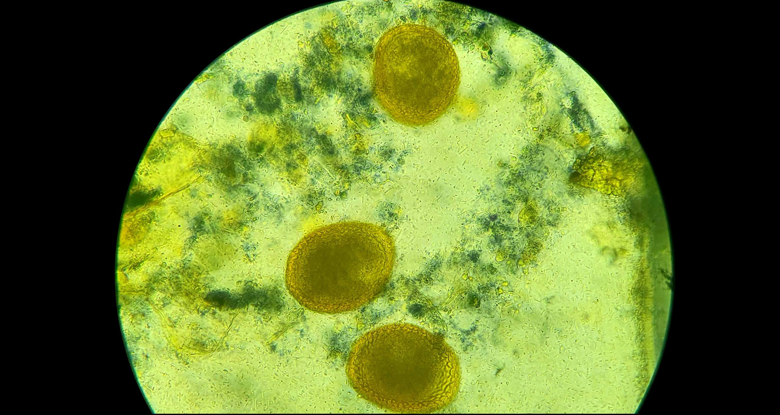 Coproparasitario