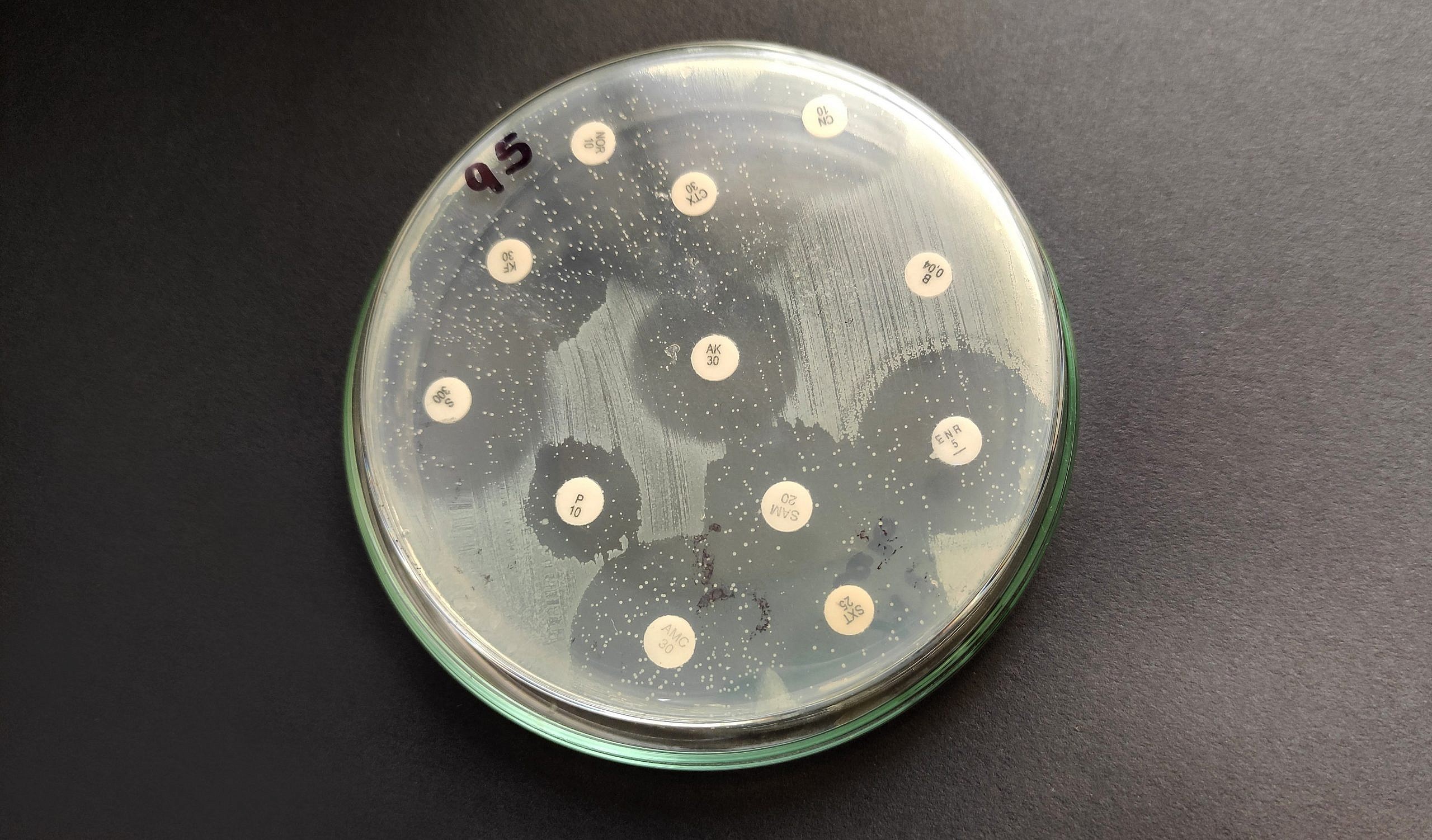 Staphylococcus aureus meticilino resistente MRSA