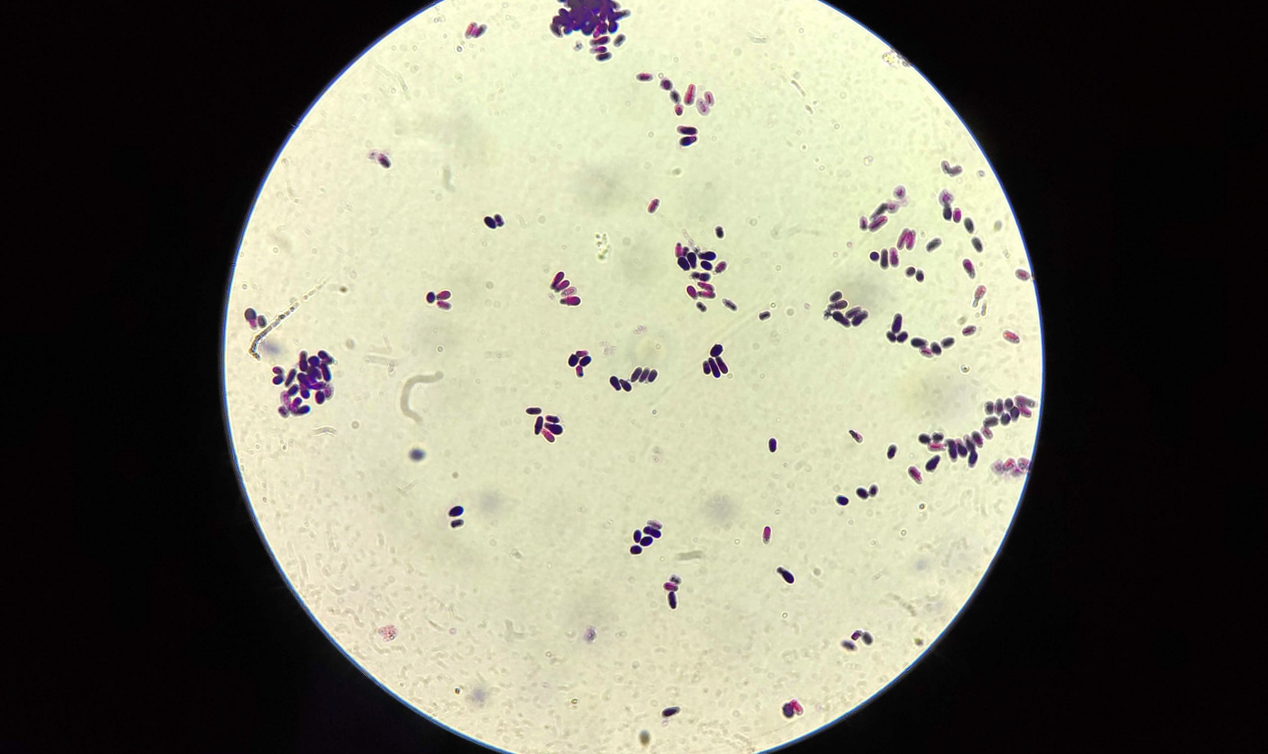 malassezia
