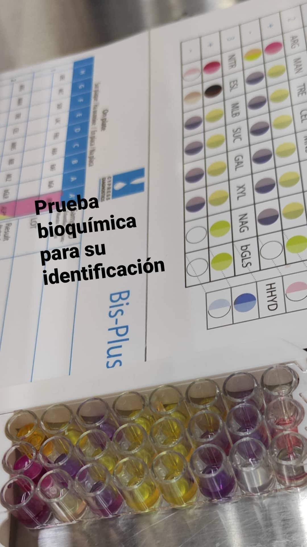 Streptococcus agalactiae