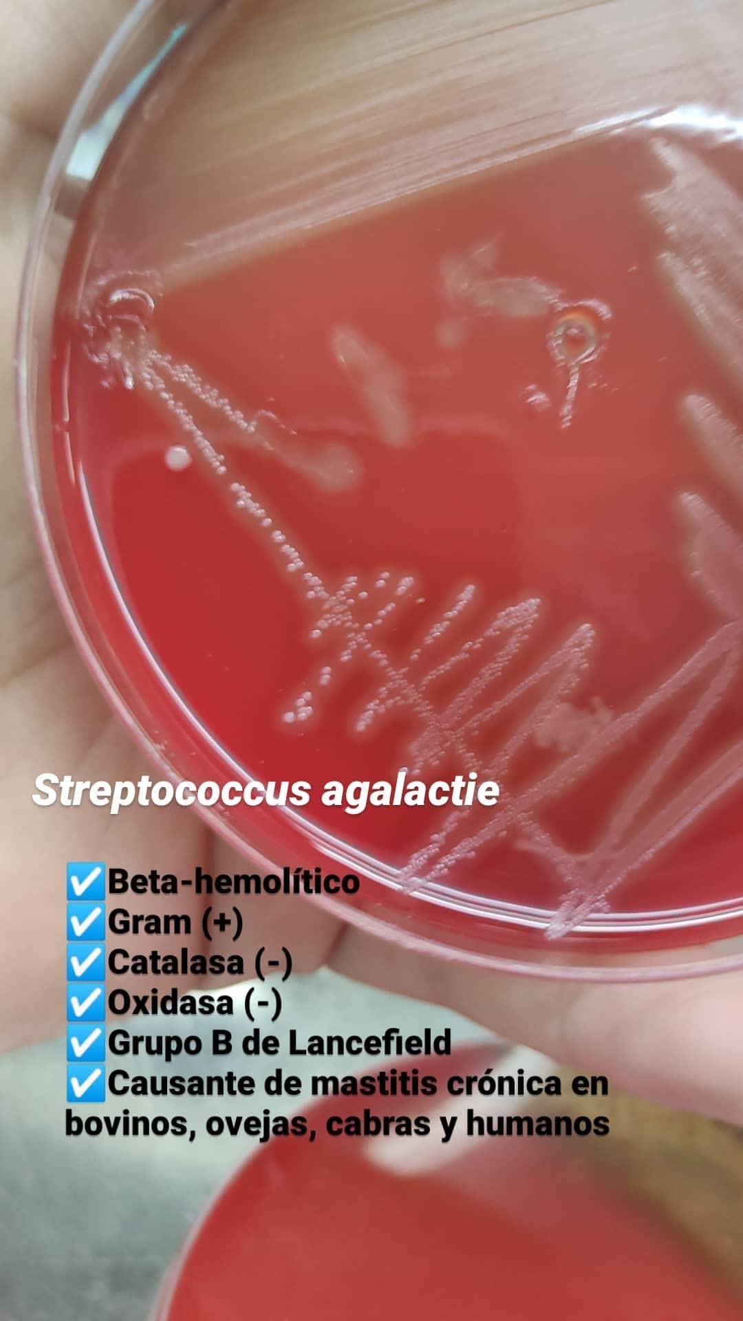 Streptococcus agalactiae