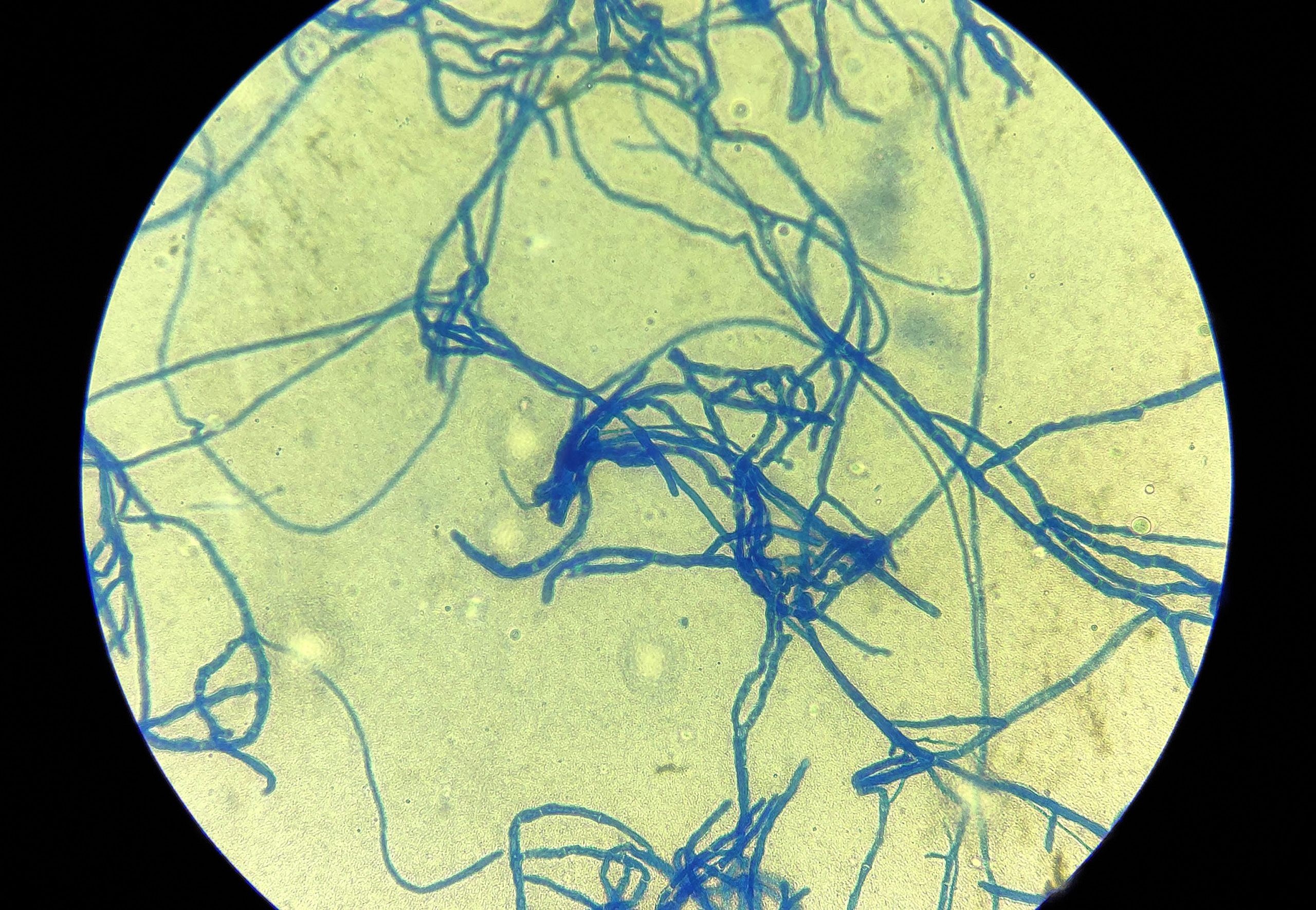 Microsporum spp.
