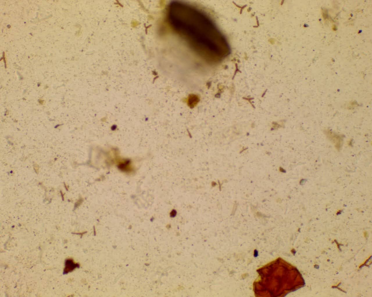 Identificación de Cyniclomices guttulatus en muestras caninas