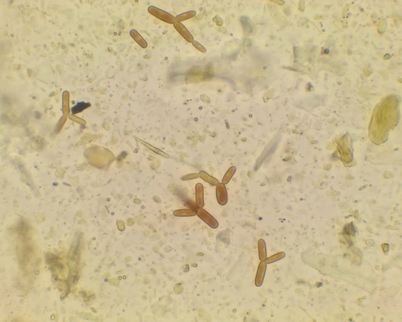 Identificación de Cyniclomices guttulatus en muestras caninas