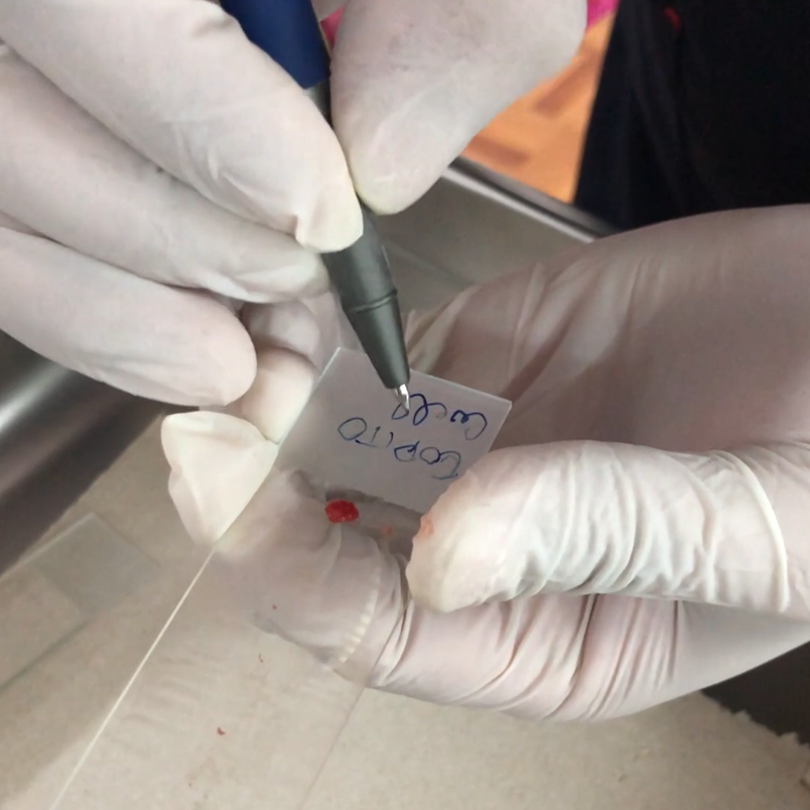 Toma de muestra citológica por PAF