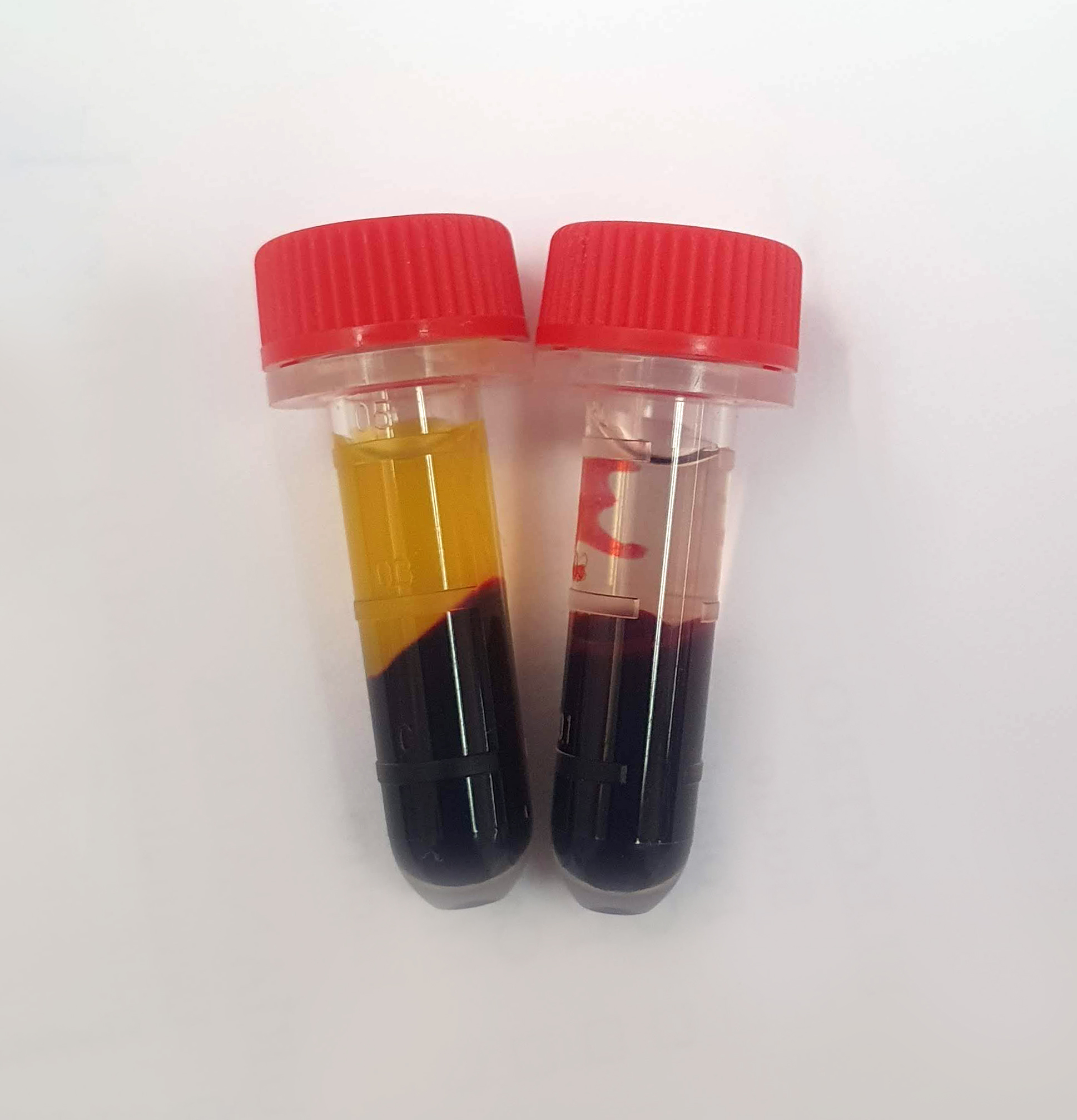 Importancia de la Química Sanguínea en la práctica diaria