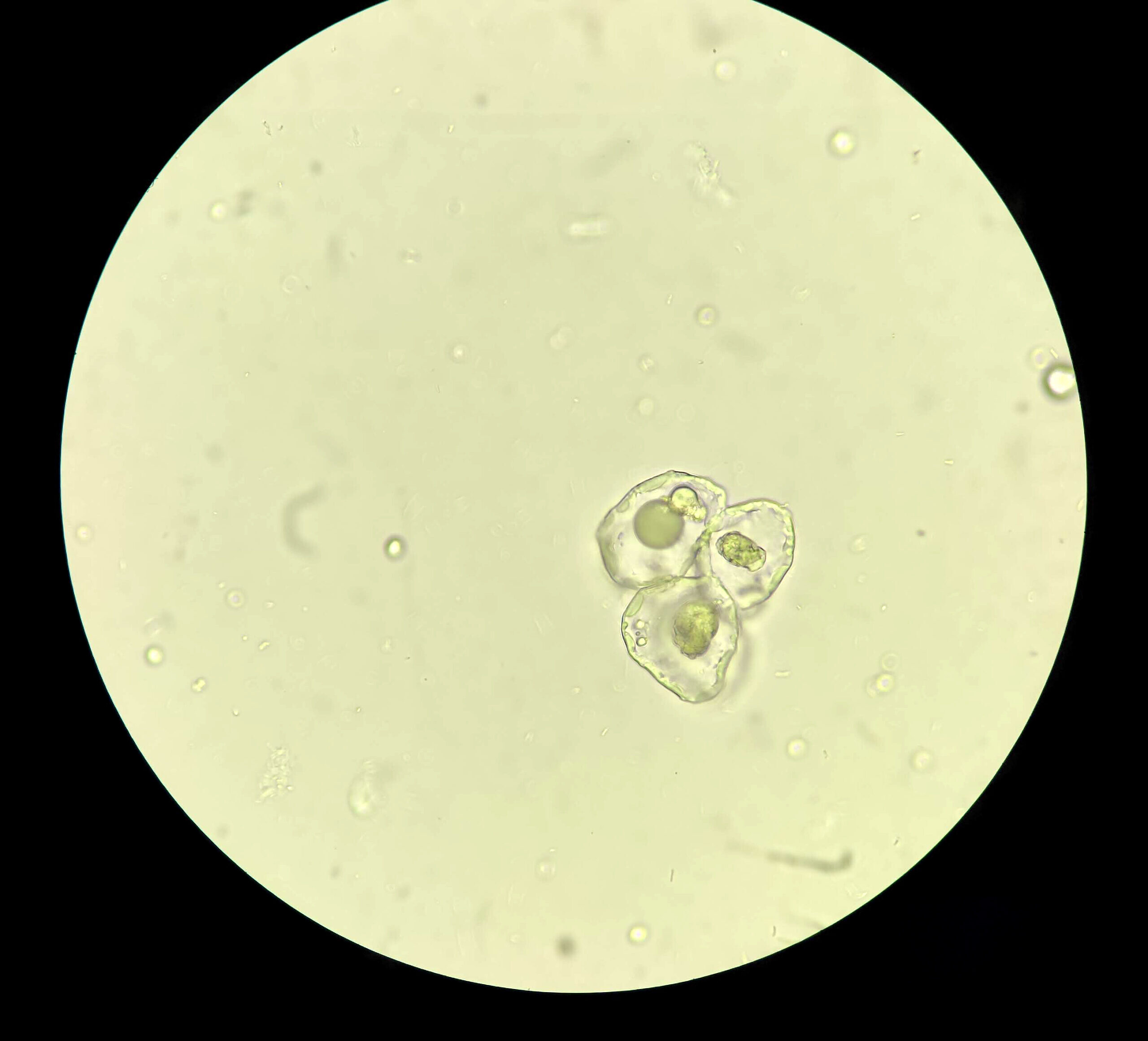 Coccidiosis en Animales de Corral