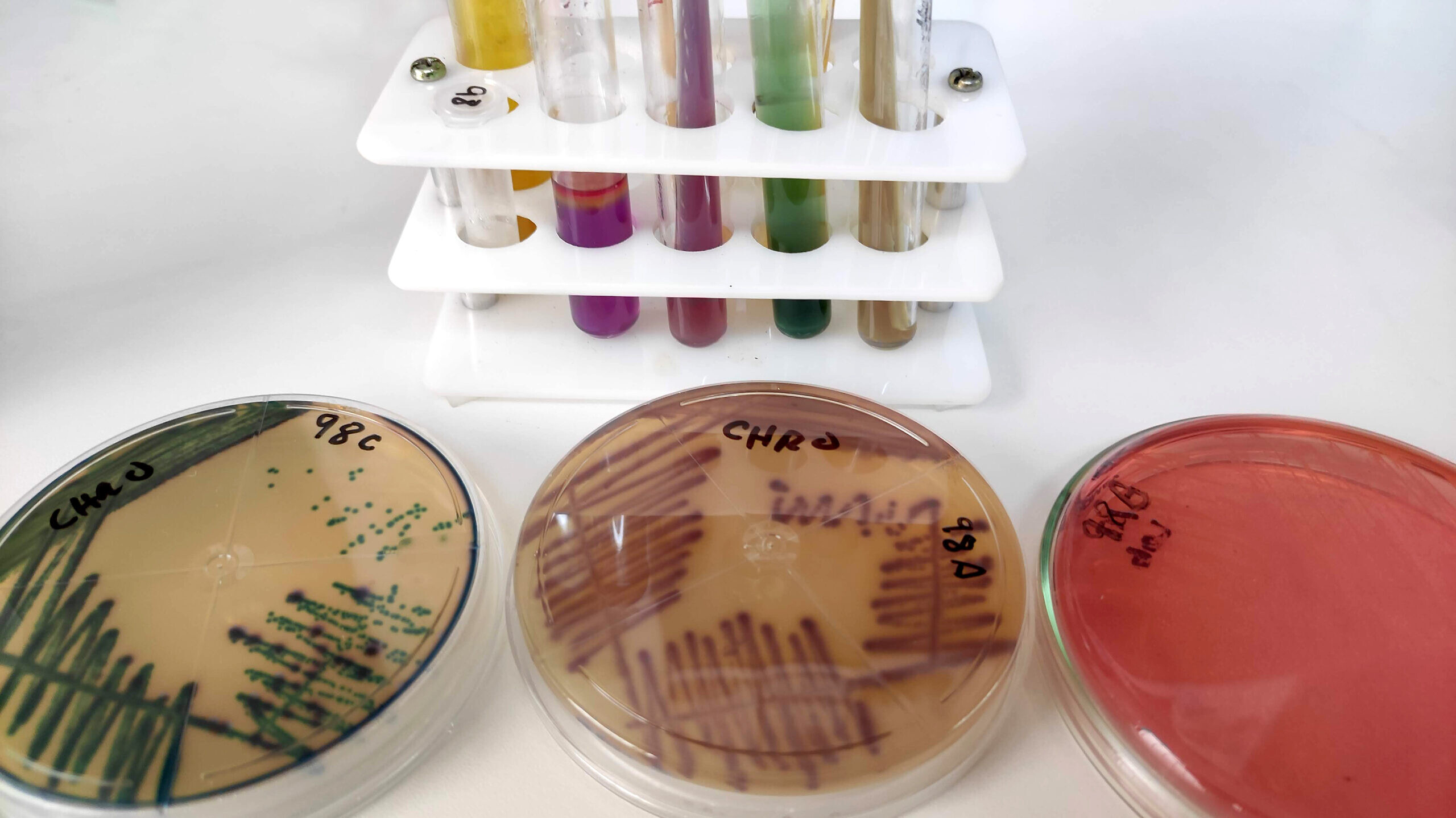 Cultivo bacteriano por sospecha de una infección urinaria multirresistente